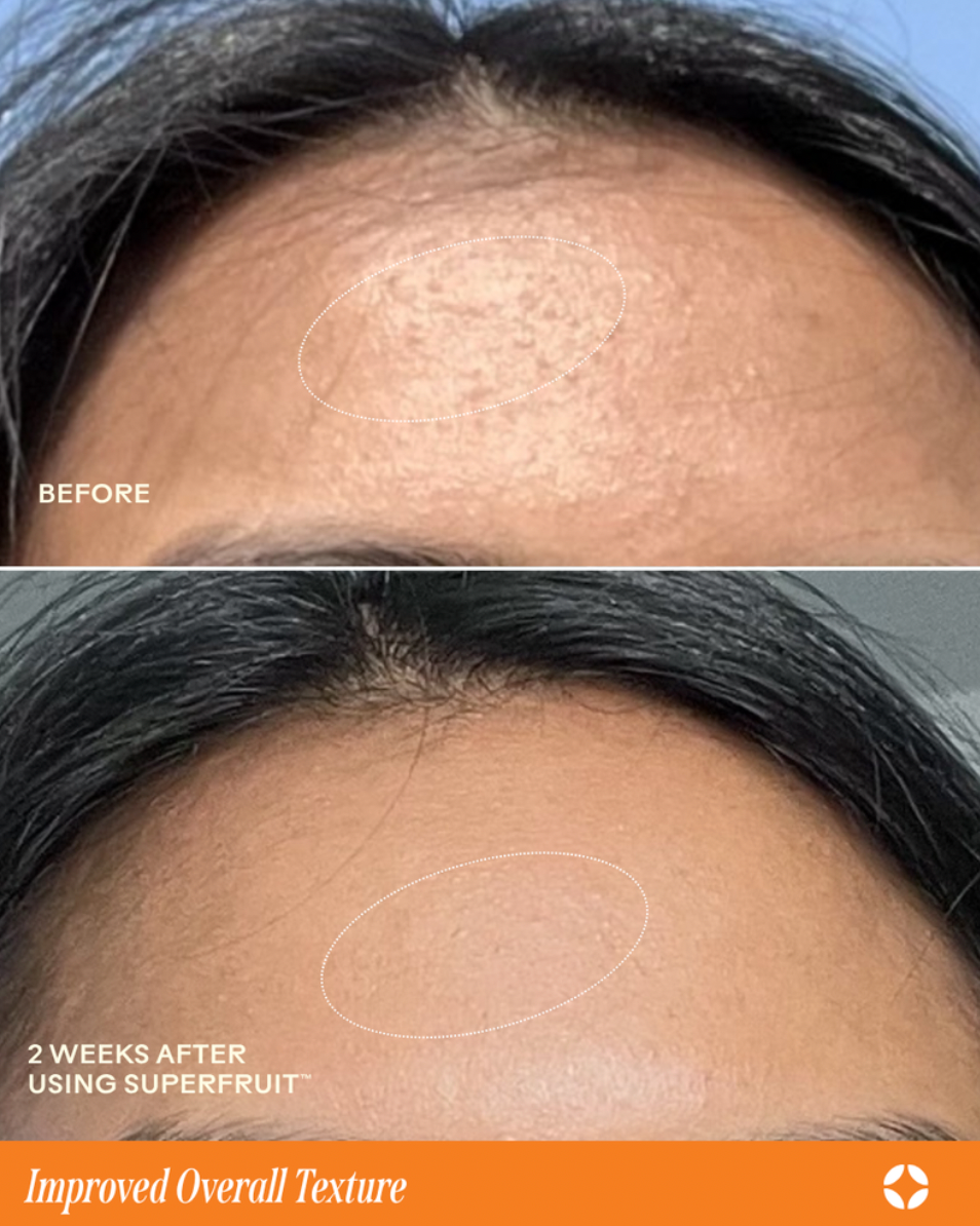 Superfruit™ Lactic + Multifruit 8% AHA Exfoliating Mask
